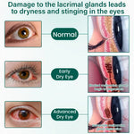 Ceoerty® OptiClear Nano Eye Roller Serum