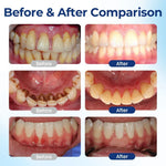 GUM CARE DROPS MOUTHWASH