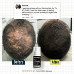 Hairfillup Hair Concealer